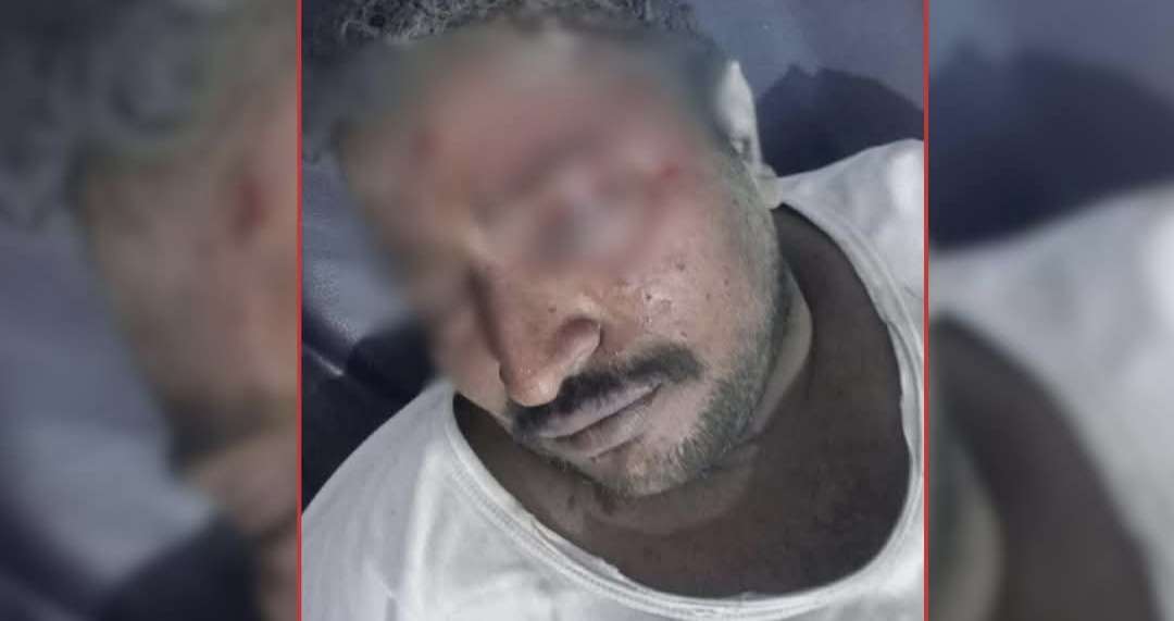 اصابة مواطن بانفجار مروع