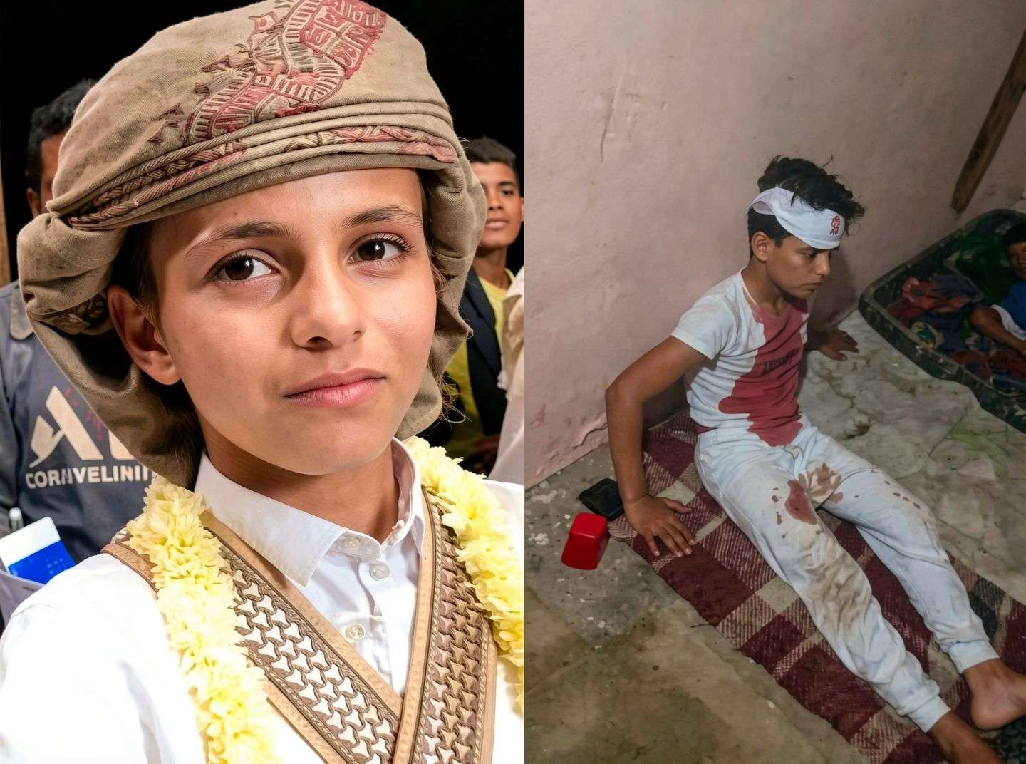 حقيقة الاعتداء على "أصغر عريس باليمن".. أسرة ريان الأدبعي تكشف التفاصيل وتنفِي وجود عصابة