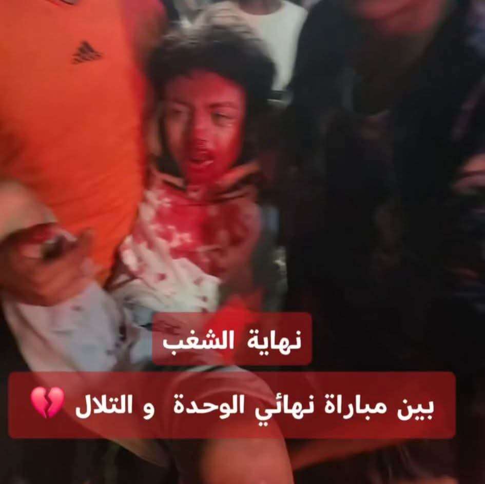 أحداث مؤسفة تعكر كلاسيكو عدن.. إصابات بين الجماهير ومطالبات بمحاسبة المسؤولين