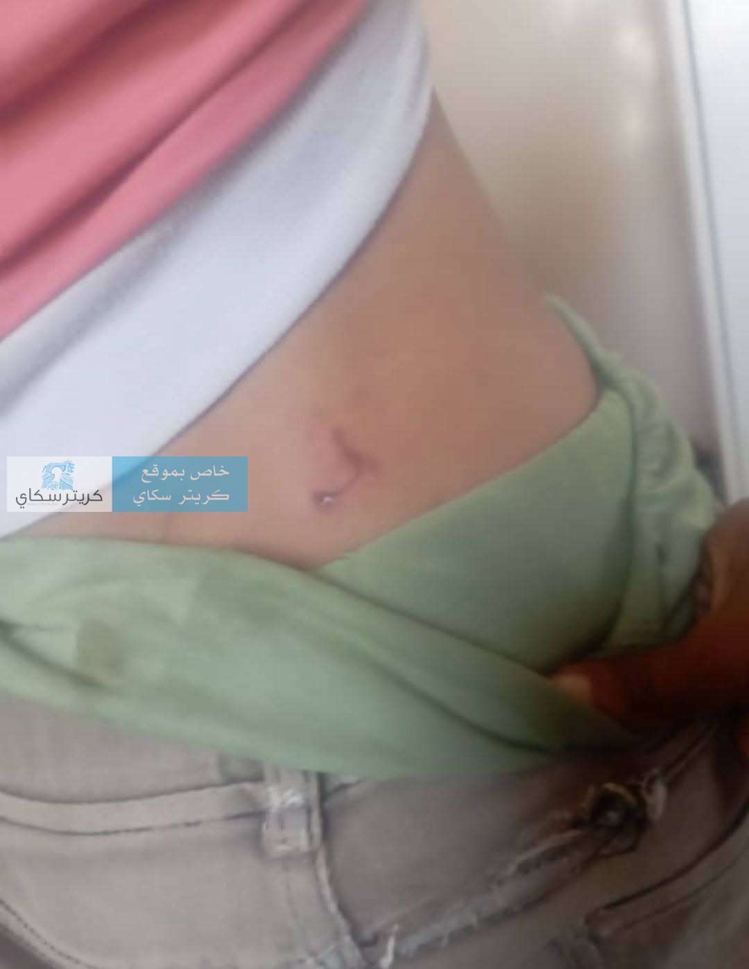 عاجل:إصابة طفل بعضة كلب يُشتبه بإصابته بالسعار في التربة.. ومطالبات بتحرك عاجل