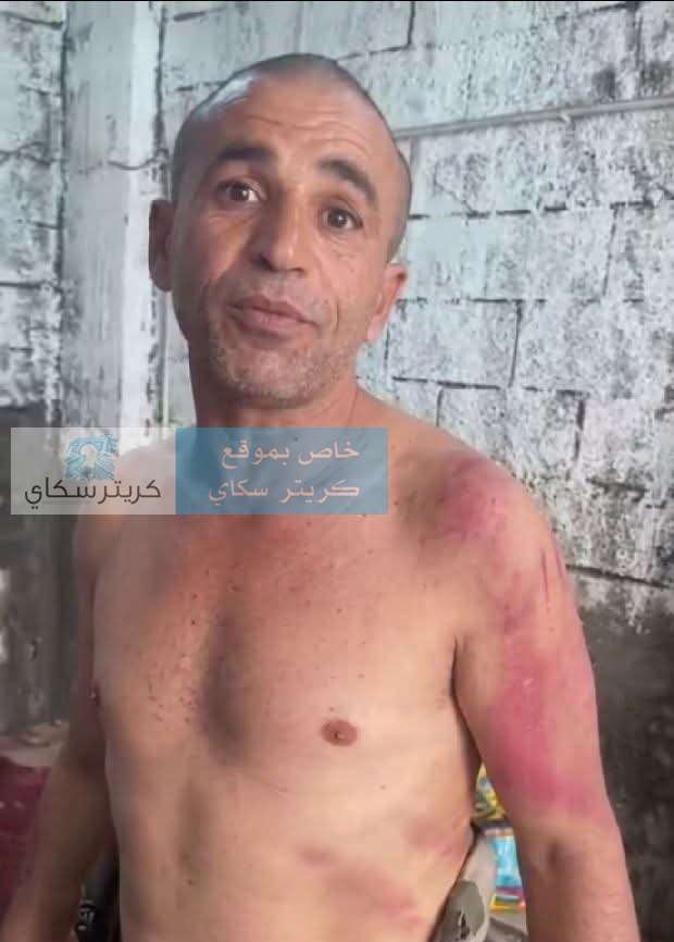 مواطن يروي تعرضه للاعتداء ويطالب بفتح تحقيق
