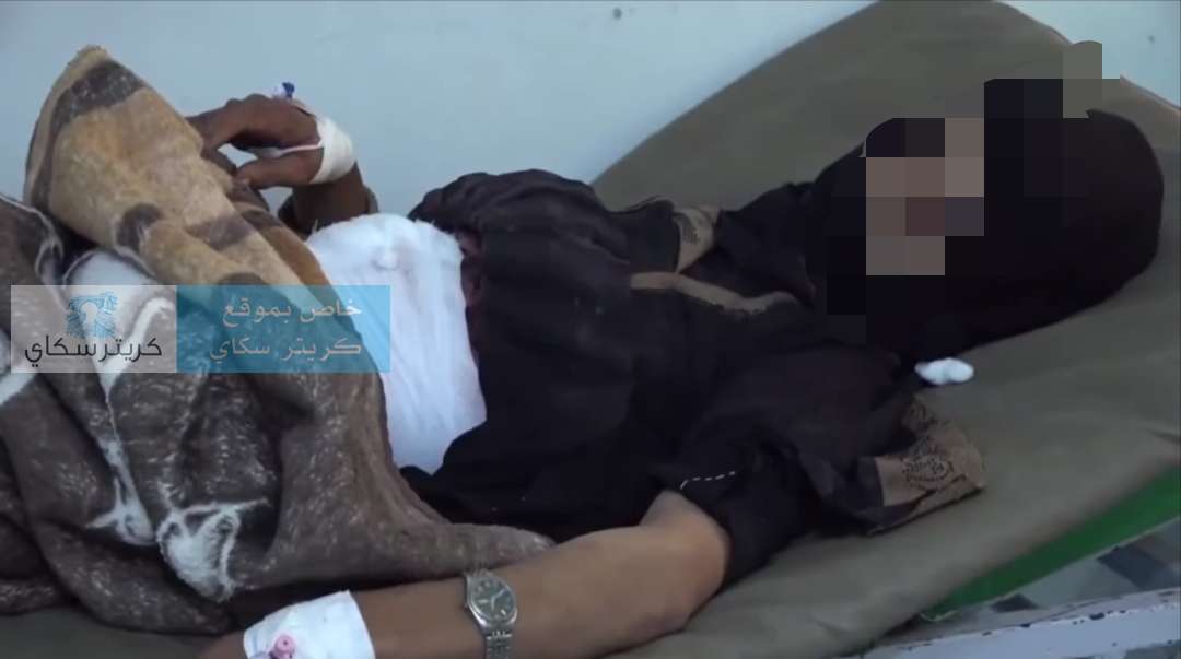 امرأة بين الحياة والموت بعد استهدافها برصاص قناص حو ثي أثناء رعي الأغنام