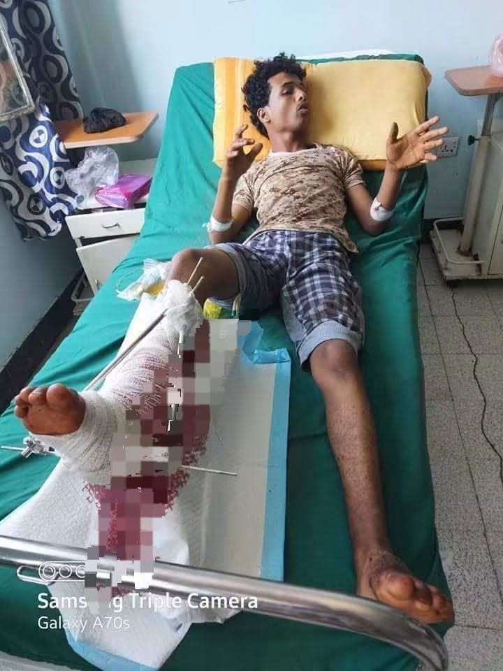 معتز الاعرج يروي معاناته: ثلاث سنوات من الألم والإهمال.. والعلاج أصبح بالوساطة