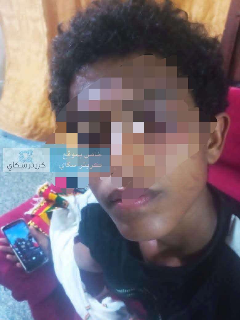 ذهب لصلاة الفجر فعاد بعين مصابة.. اعتداء على طفل داخل مسجد في عدن يثير الغضب