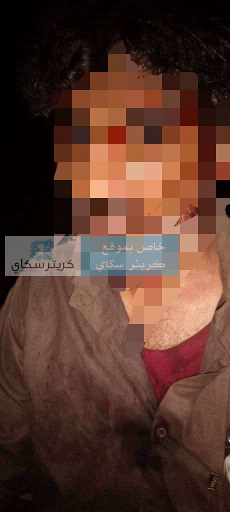 عاجل: عناصر تابعة للانتقالي تعتدي على ناشط وإعلامي