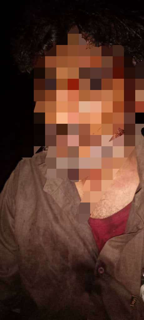 ناشط ردفاني يتهم عضوًا في الانتقالي بالاعتداء عليه ويتوعد بكشف التفاصيل