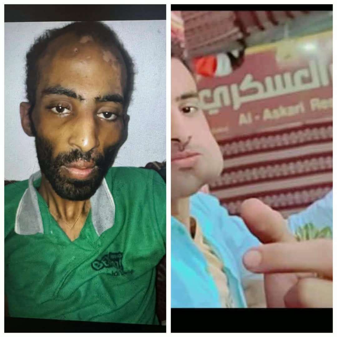 قضية الشاب ماجد تهز الشارع.. خطف وتعذيب أم حادث مروري؟