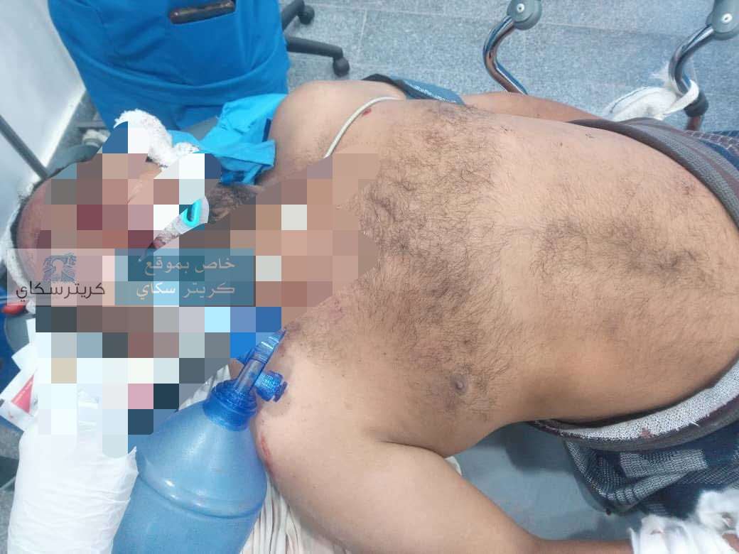 لا بطاقة ولا هاتف.. مصاب مجهول يرقد في غيبوبة بعد حادث مروري
