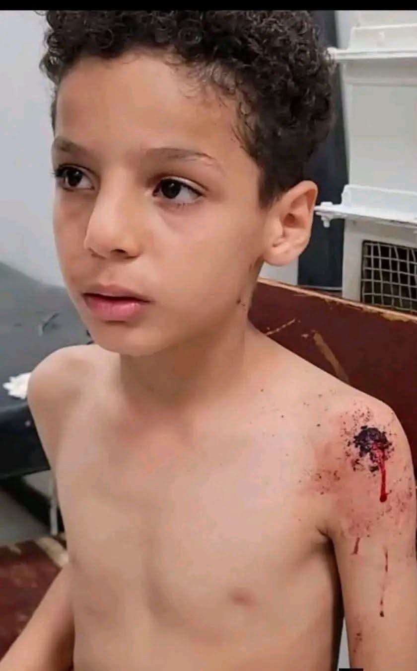 إصابة طفل بشظية جراء قذيفة حوثية