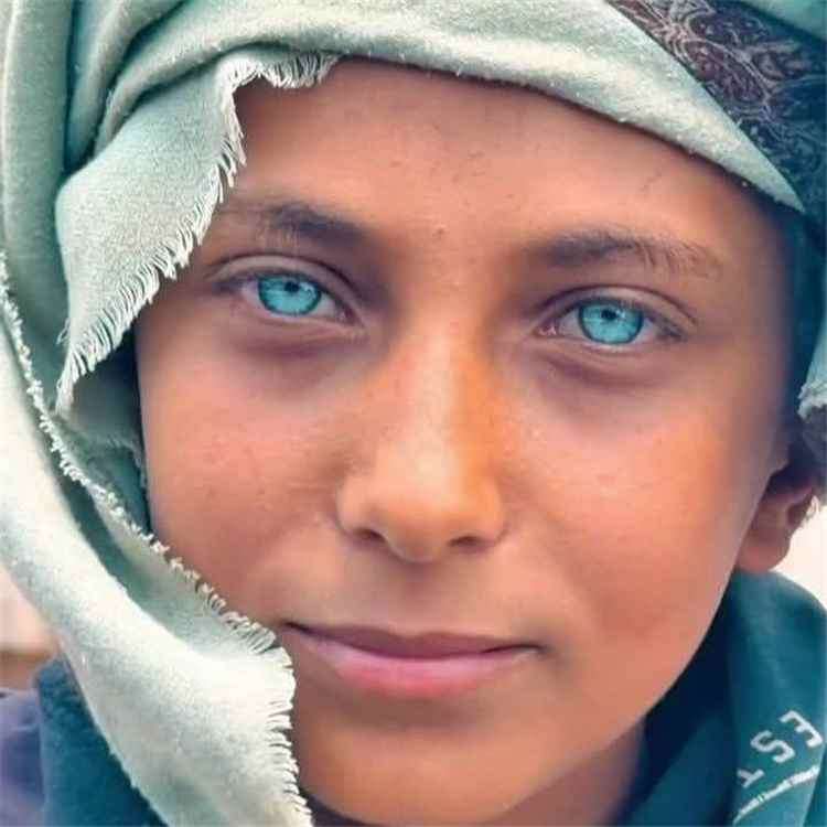 مراهق يمني بعيون زرقاء يتحول إلى ظاهرة على مواقع التواصل بـ30 مليون مشاهدة