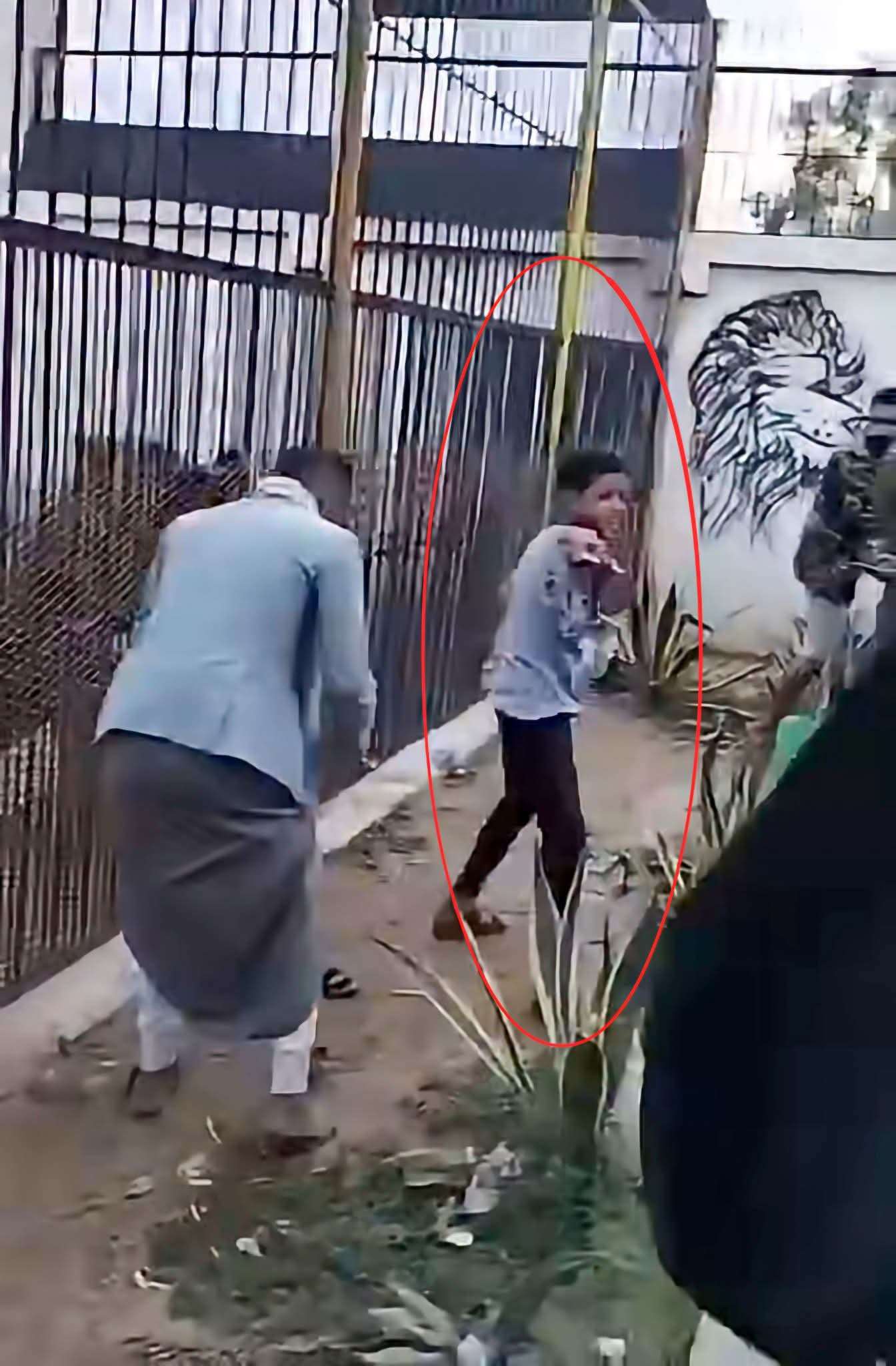 أول صورة للطفل بعد حادثة حديقة الحيوان في صنعاء