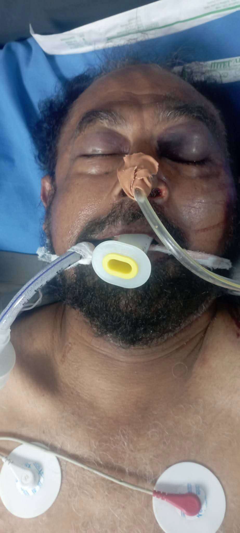 مناشدة للتعرف على هوية رجل مجهول يرقد في العناية المركزة بعدن