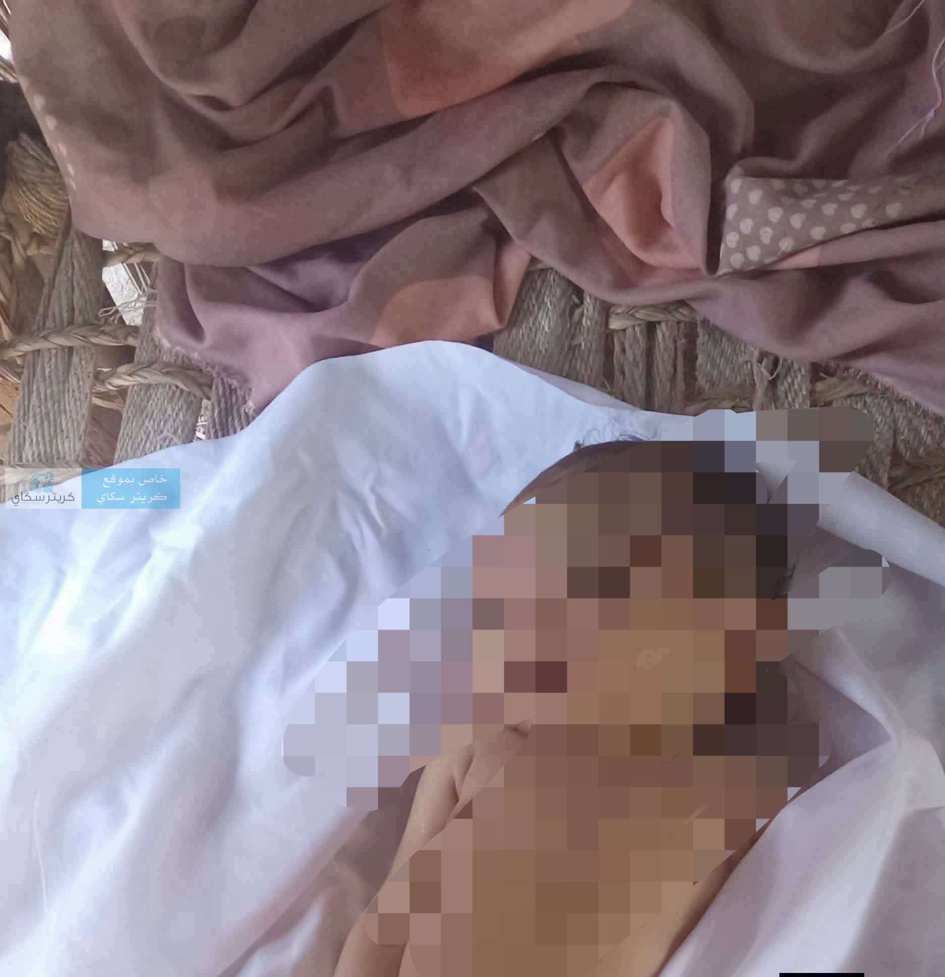 صورة تختصر المأساة.. طفلة من المضاربة ضحية للقصف الحو ثي