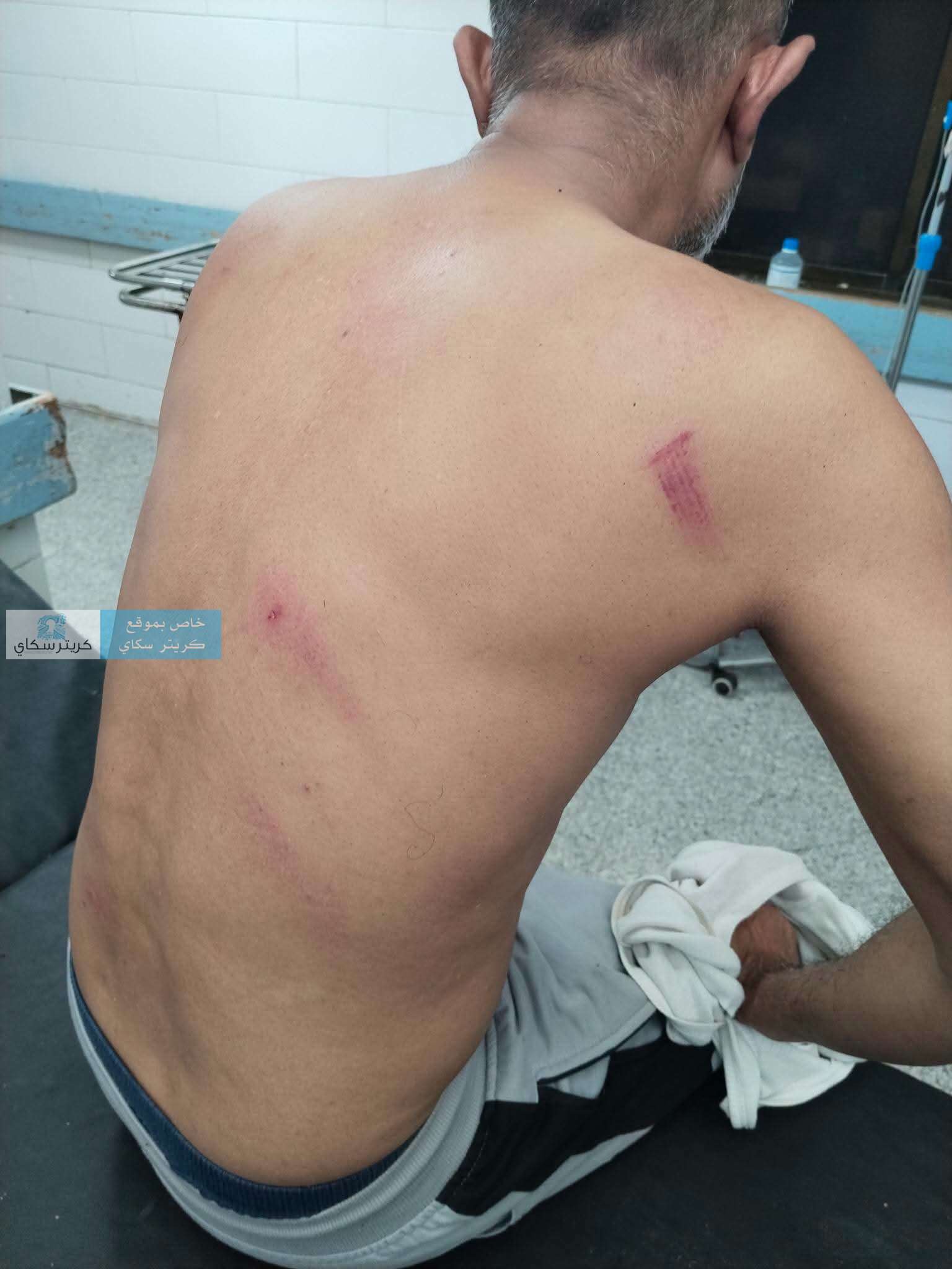عاجل:تعرض المحامي نزار سرارو للضرب والطعن.. واتهام لشرطة خورمكسر برفض ضبط المعتدين