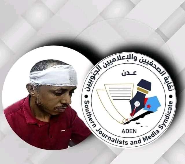 عاجل : نقابة الصحفيين الجنوبيين تحدد موقفها بشان الاعتداء على الصحفي ابو عوذل