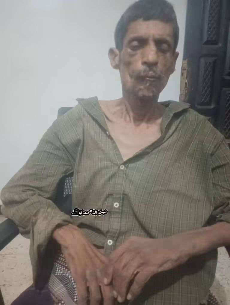 عاجل | شرطة كابوتا تعثر على شخص بحالة صحية متعبة في عدن وتنقله إلى المستشفى
