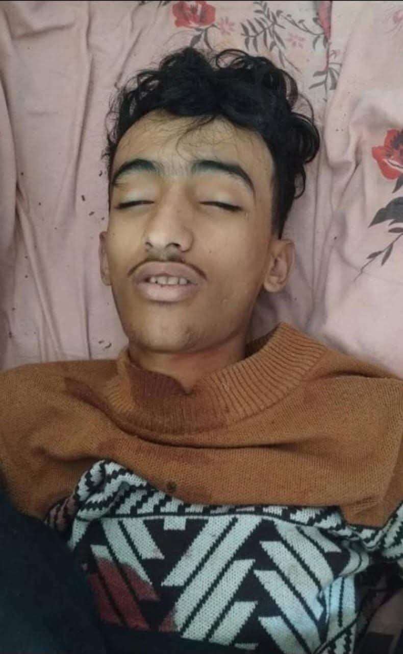 جريمة مروّعة ..  الحو ثيين يقتلون الطفل عمار ياسر الشريحي في تعز والسبب صادم !