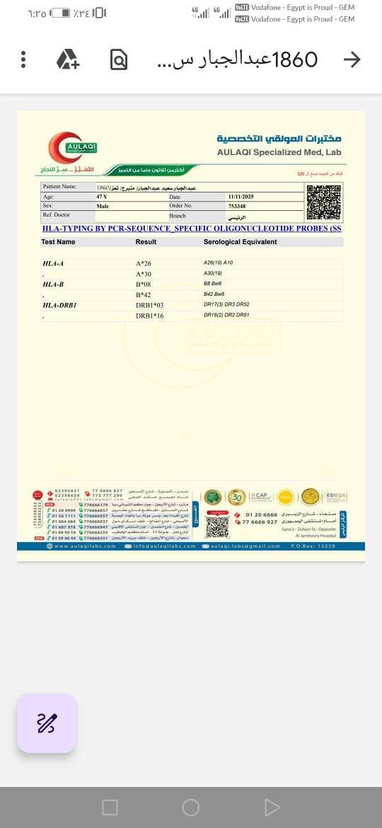 شاب يمني مصاب بالفشل الكلوي مرقد في مصر يناشد بانقاذ حياته