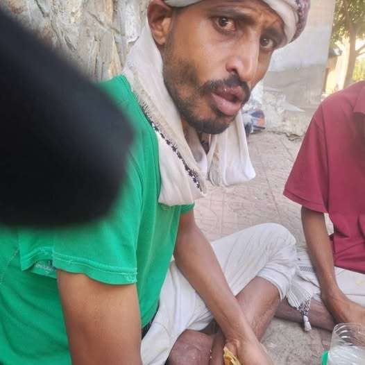 ضياع مريض نفسي في تعز يقود إلى احتجازه مؤقتًا